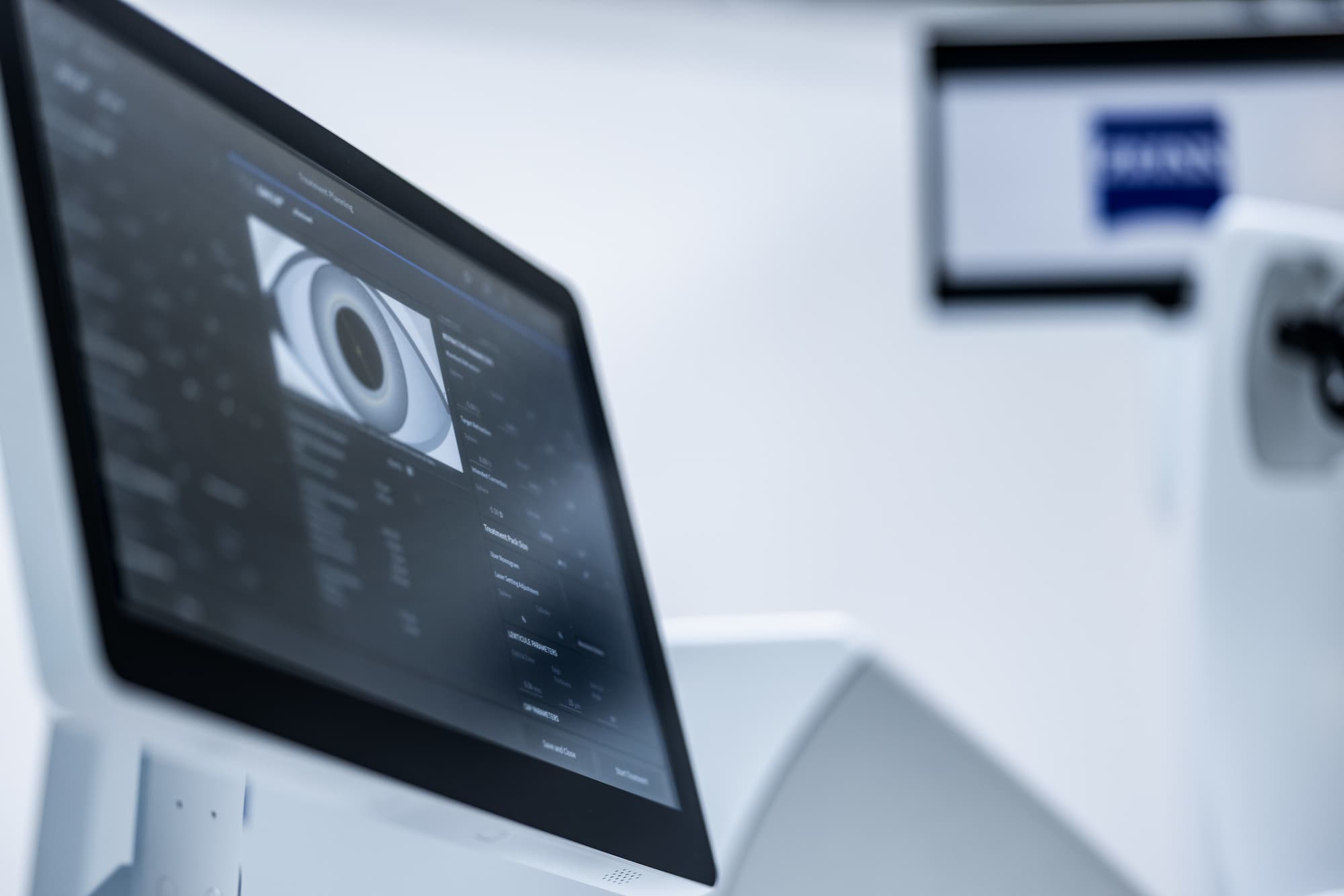 Planungsbildschirm des ZEISS VISUMAX 800 mit Augenaufnahme