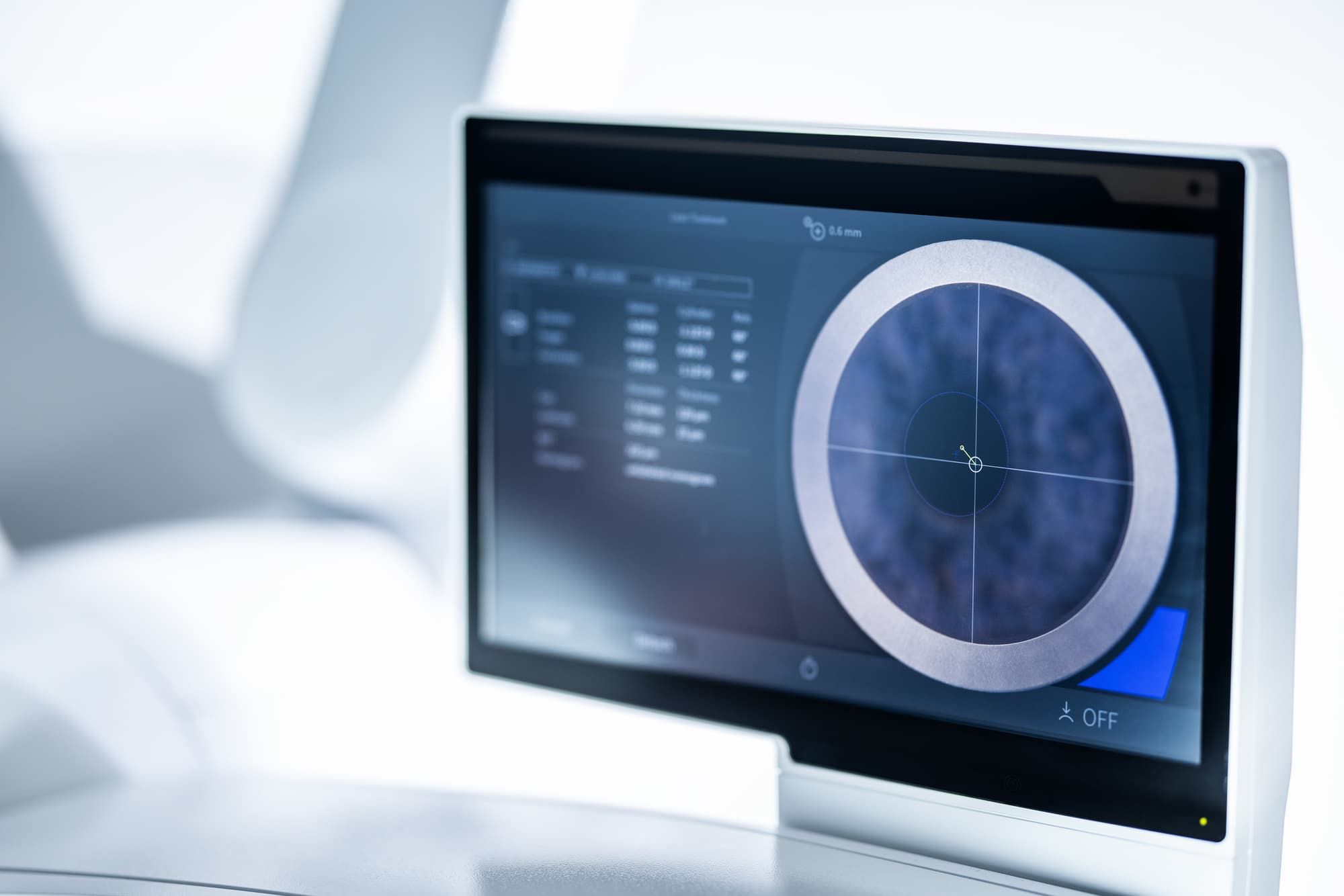 Behandlungsbildschirm des ZEISS VISUMAX 800 mit Zentrierhilfe CentraLign