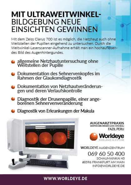 Infoblatt von WORLDEYE zur Ultra-Weitwinkel-Netzhautuntersuchung