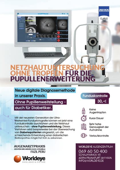 Infoblatt von WORLDEYE zur Netzhautuntersuchung